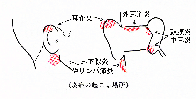 耳鼻科の急病画像