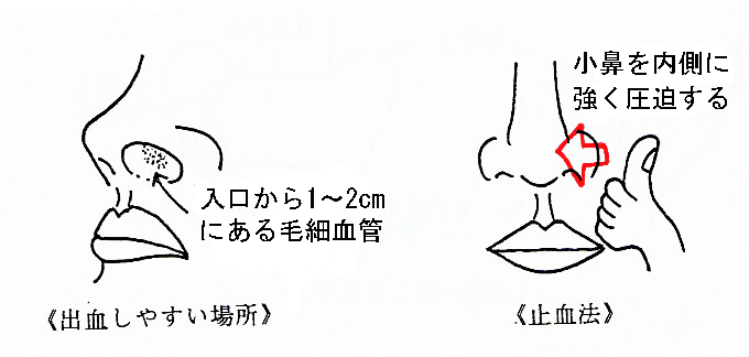耳鼻科の急病画像