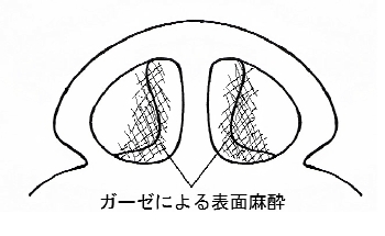 鼻の病気画像