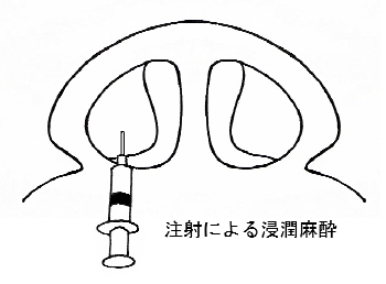 鼻の病気画像