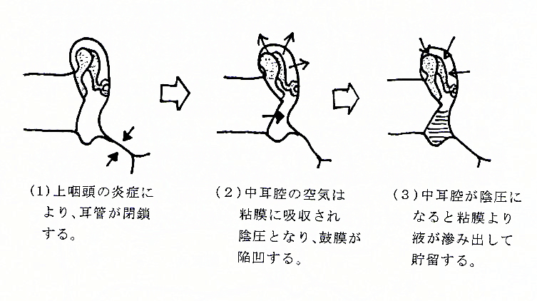 耳の病気画像